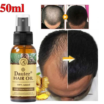 Najnovejši lase eterično olje izdelek anti hair loss spray bistvo zdravljenje suhe kodraste poškodovanih las tanke hrano